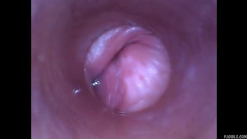 Камера в вагине 2