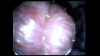 У врача на приеме, анал и эндоскоп