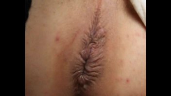 Укол прямо в анус